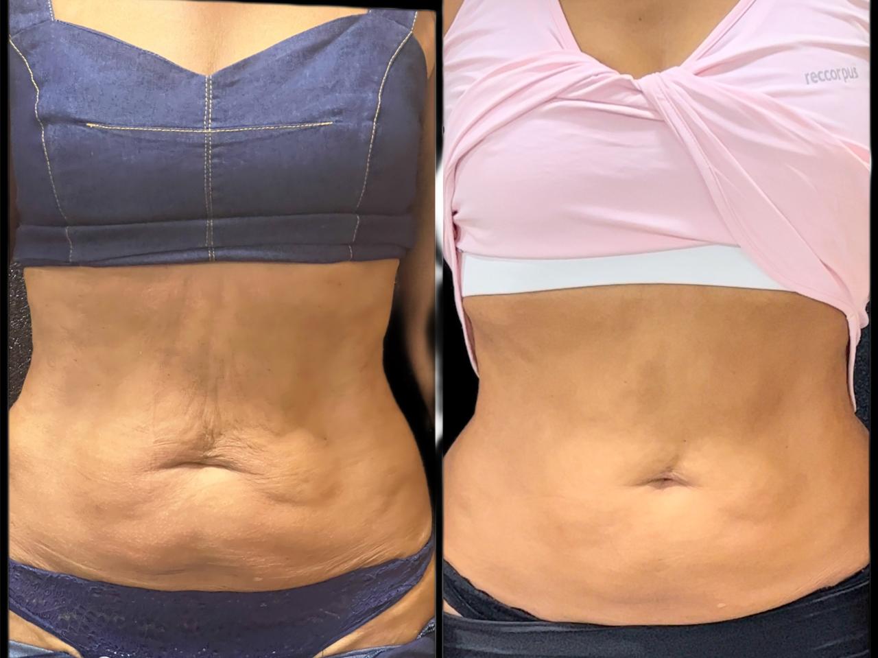 WhatsApp Image 2026-02-24 at 2.08.13 PM